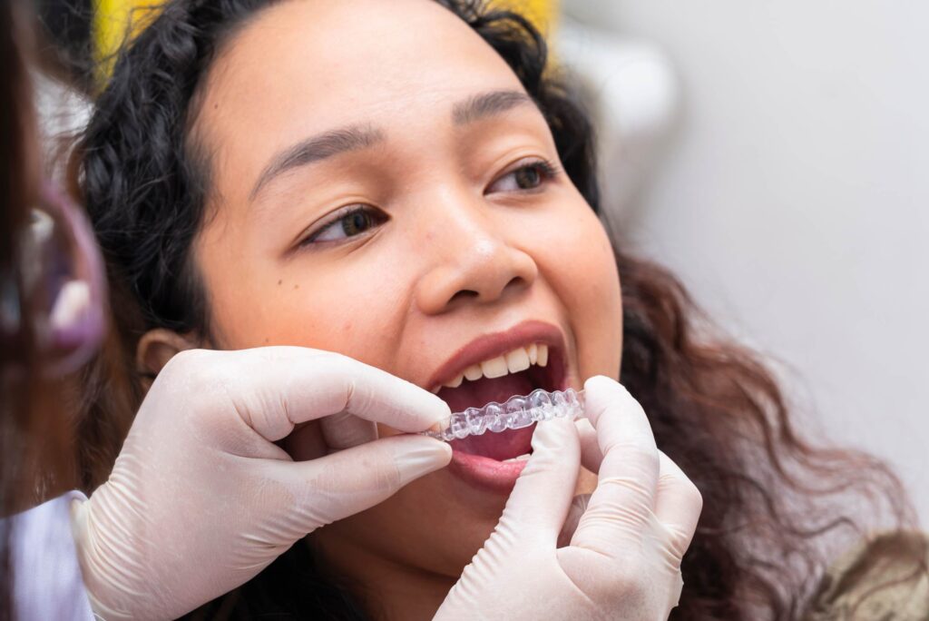 dentist demonstrates and inserts clear aligners