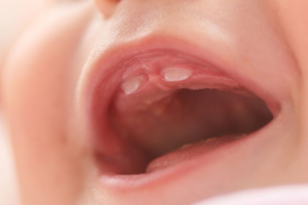 infant tooth eruption