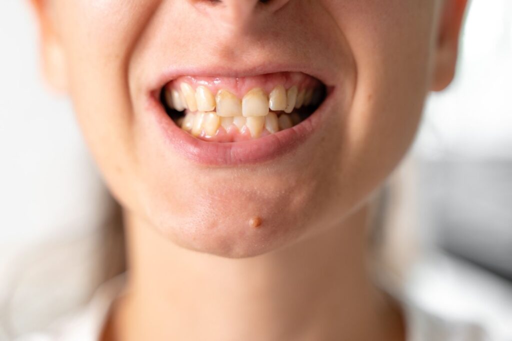 orthodontic problems