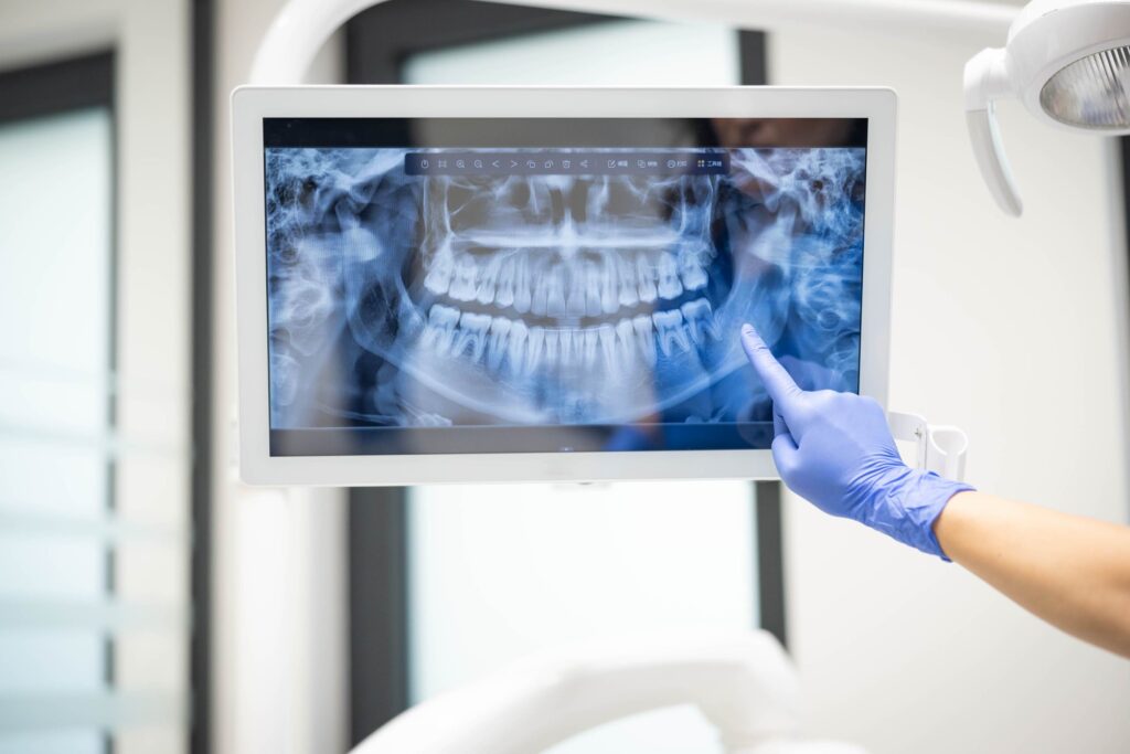 dental x ray displayed on a monitor