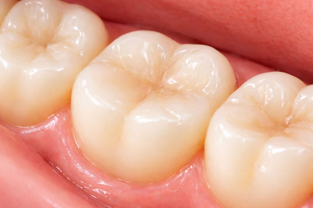 tooth filling services